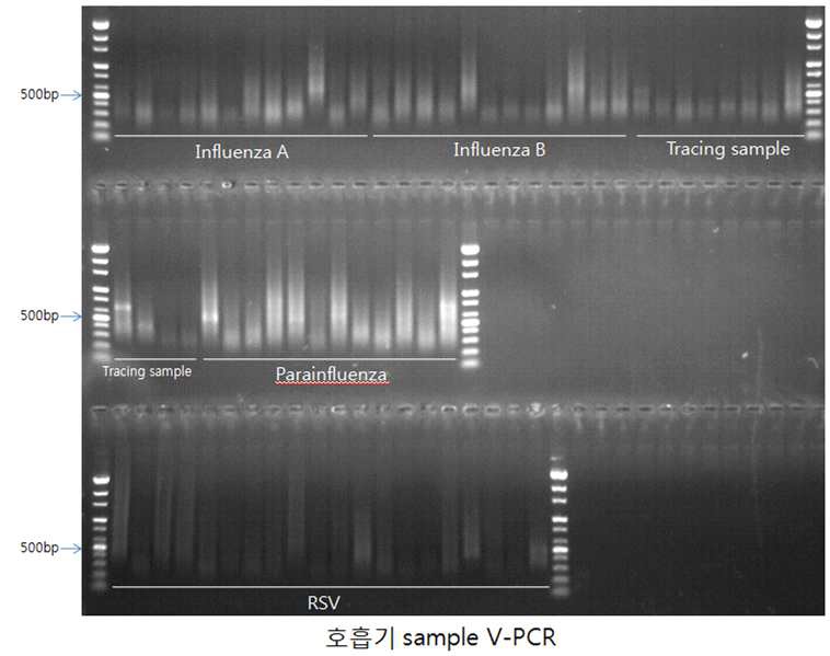 바이러스 메타게놈 라이브러리 제작을 위한 Ad-PCR product의 gel-image