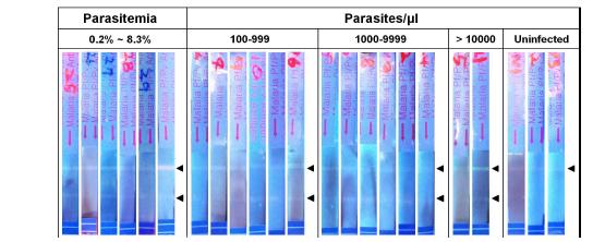 삼일열말라리아 환자 혈액을 이용한 원충혈증에 따른 FICT 검사 결과