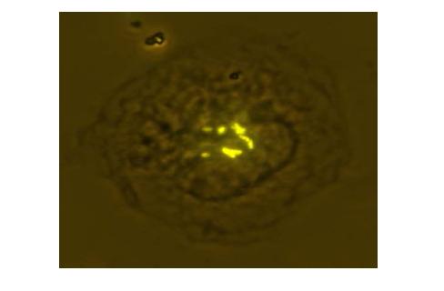 사람 큰포식세포에 감염된 Mycobacterium avium 표준균주의 형광염색 사진 (x 1000, ZEISS AX10)