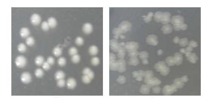 Middlebrook 7H10 고체 배지에서 배양된 Mycobacterium abscessus 균주의 활면집락 (smooth colony) 및 조면집락 (rough colony).