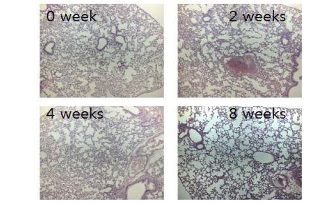 NTM을 감염시키지 않은 마우스 폐조직의 0, 2, 4, 8주 H&E 염색 사진
