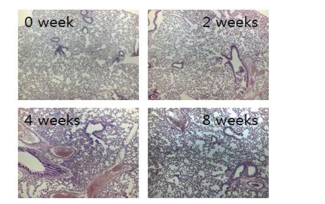 M. avium ATCC25291을 감염시킨 마우스 폐조직의 0, 2, 4, 8주 H&E 염색 사진