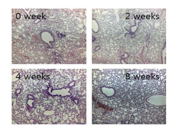M. avium colonization 균주를 감염시킨 마우스 폐조직의 0, 2, 4, 8주 H&E 염색사진.