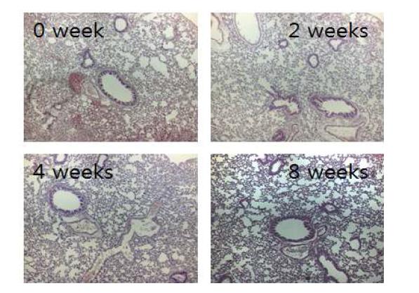 M. avium lung disease 균주를 감염시킨 마우스 폐조직의 0, 2, 4, 8주 H&E 염색 사진