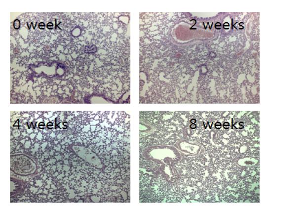M. intracellulare ATCC13950 균주를 감염시킨 마우스 폐조직의 0, 2, 4, 8주 H&E 염색 사진