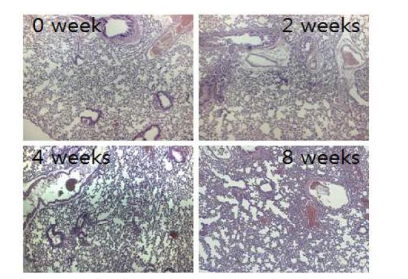 M. intracellulare colonization 균주를 감염시킨 마우스 폐조직의 0, 2, 4, 8주 H&E 염색 사진