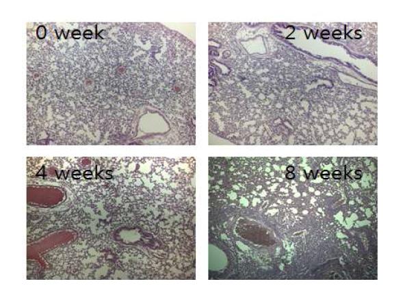 M. intracellulare lung disease 균주를 감염시킨 마우스 폐조직의 0, 2, 4, 8