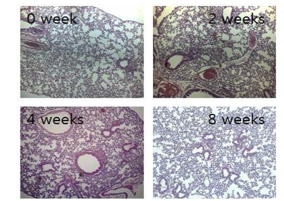 M. abscessus ATCC19977 균주를 감염시킨 마우스 폐조직의 0, 2, 4, 8주 H&E 염색 사진