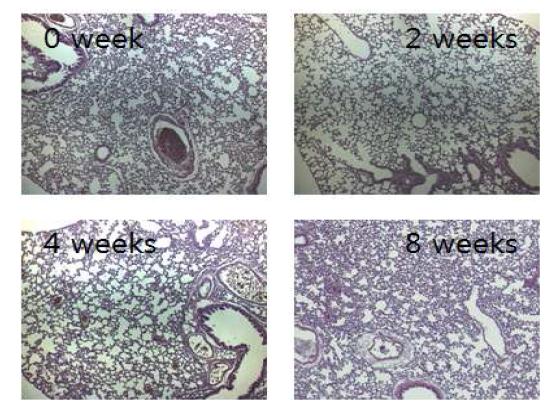 M. abscessus smooth type 균주를 감염시킨 마우스 폐조직의 0, 2, 4, 8주 H&E 염색 사진