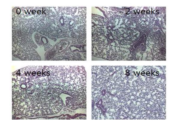 M. abscessus rough type 균주를 감염시킨 마우스 폐조직의 0, 2, 4, 8주 H&E 염색 사진