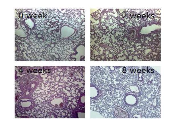 M. massiliense KCTC19086 균주를 감염시킨 마우스 폐조직의 0, 2, 4, 8주 H&E 염색 사진
