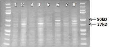 Figure 11. Western blot profiles of RSV-G proteins expressed in RosettaTM 2(DE3)pLysS host cell with anti-6XHis antibody