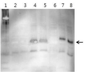 Figure 14. Western blot profiles of RSV-G proteins expressed in BL21(DE3) host cell with anti-6XHis antibody