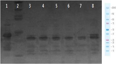 Figure 18. Western blot of non tagging RSV A2-G protein 1st purification condition through EK(enterokinase) enzyme cleavage site