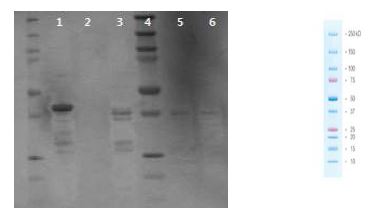 Figure 19. Western blot of non tagging RSV A2-G protein 2nd purification condition through column