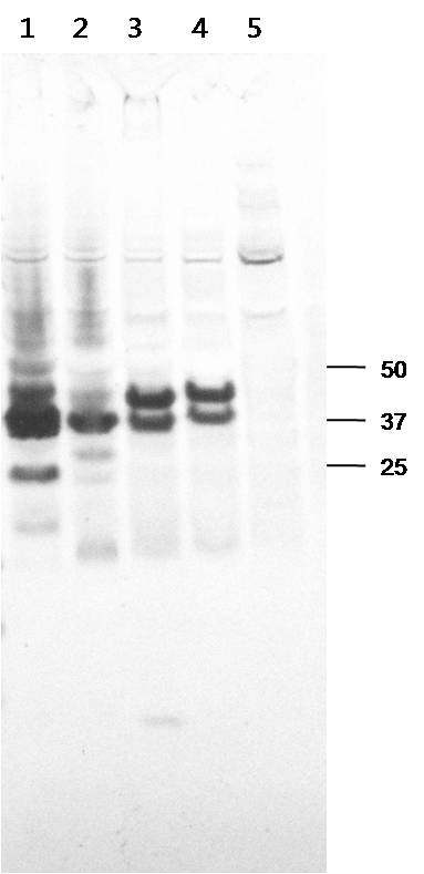 Figure 21. 재조합 baculovirus에 의한 deglycosylated RSV-G 단백질 발현