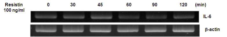 그림 16. Resistin 시간별 처리에 따른 사이토카인 발현의 변화