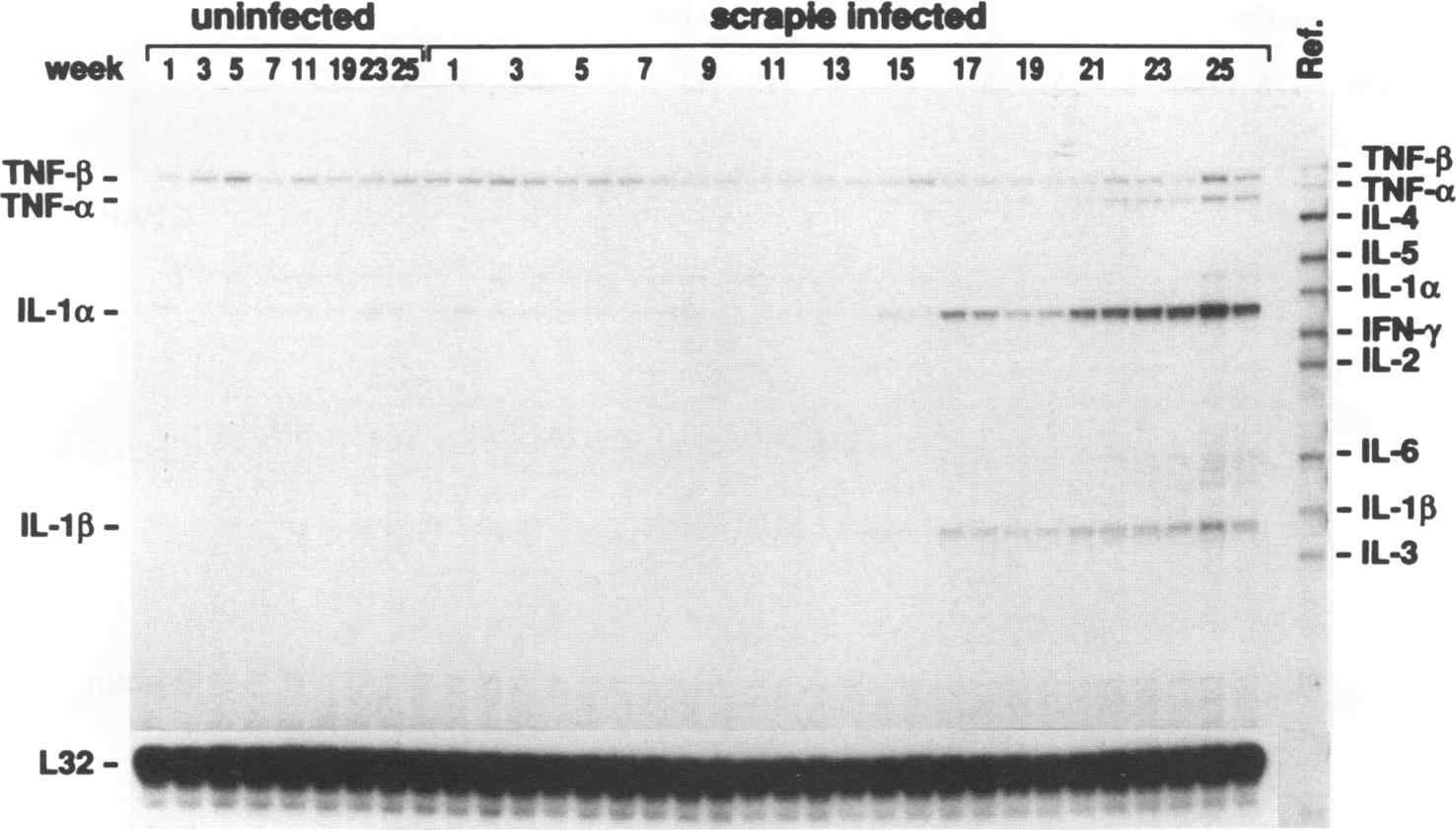 (Fig. 7-1. Comparison of cytokine mRNA expression between control and scrapie group