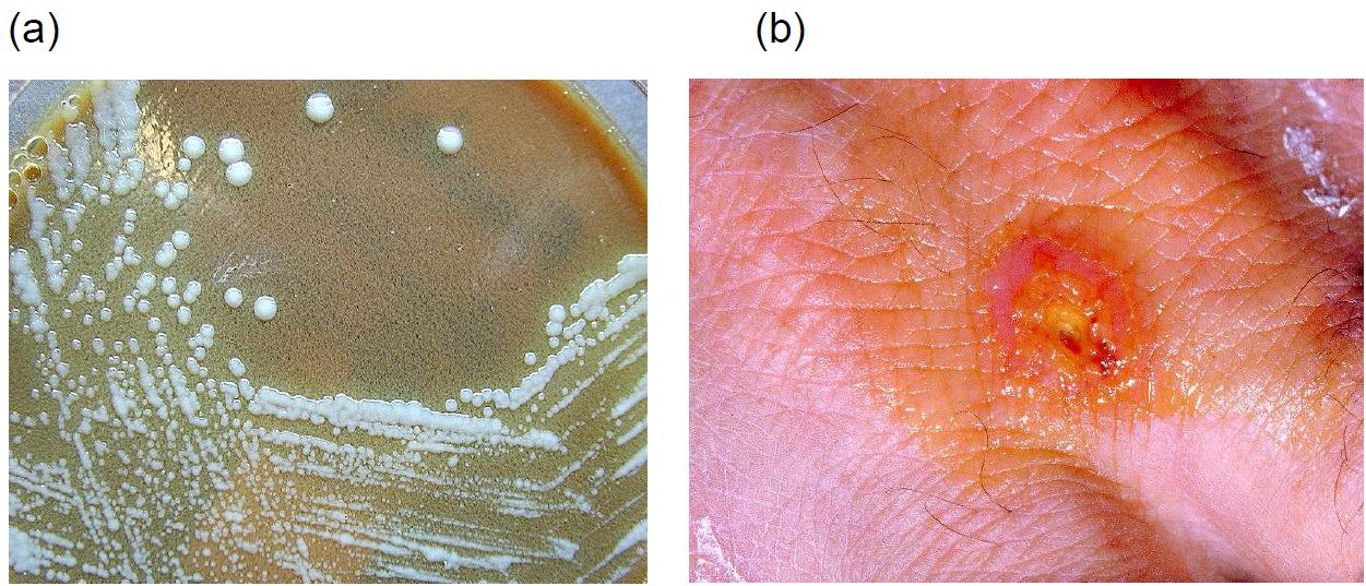 그림 1. 야토병 (tularemia)를 일으키는 Fracisella tularensis