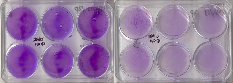 Isolation of virus clone from Balb/c-15, Balb/c-26, DBA/1J-13 and DBA/1J-21 passage by plaque purification method