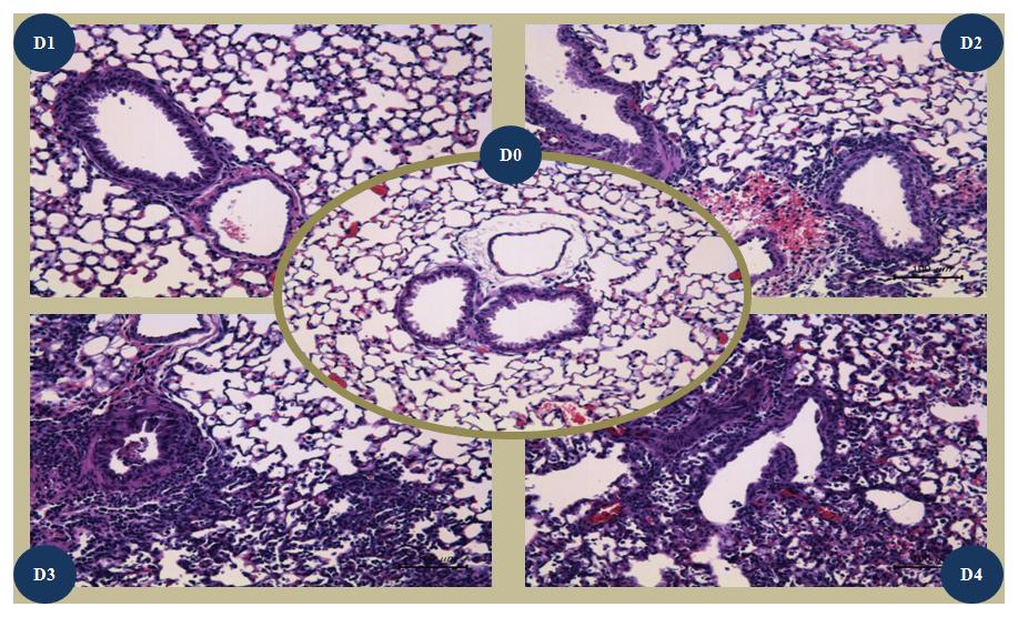 Histopathologic findings on H&E staining with lung tissues of DBA/1J mice infected with wild type influenza virus during 4 days