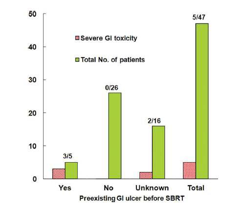 The relationbetween the presence of a pre-existing gastrointestinal(GI) ulcer and stereotactic body radiation therapy(SBRT) related severe GI