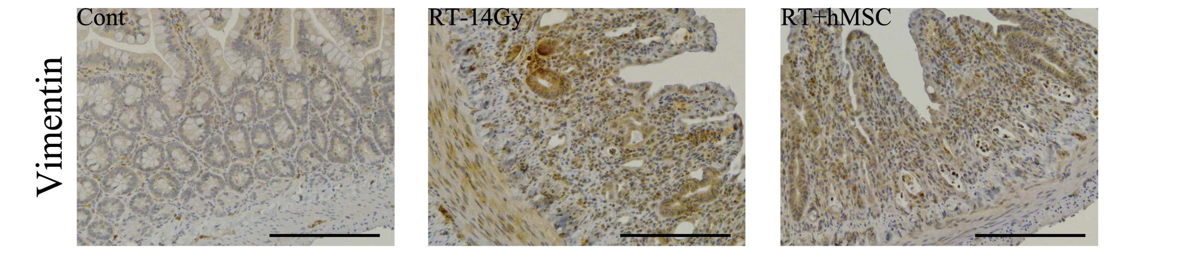 Figure 3. 방사선 피폭에 의한 Vimentin 발현변화