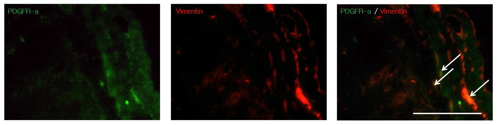Figure 4. 회장에서의 Vimentin과 PDGFR-α의 면역형광염색