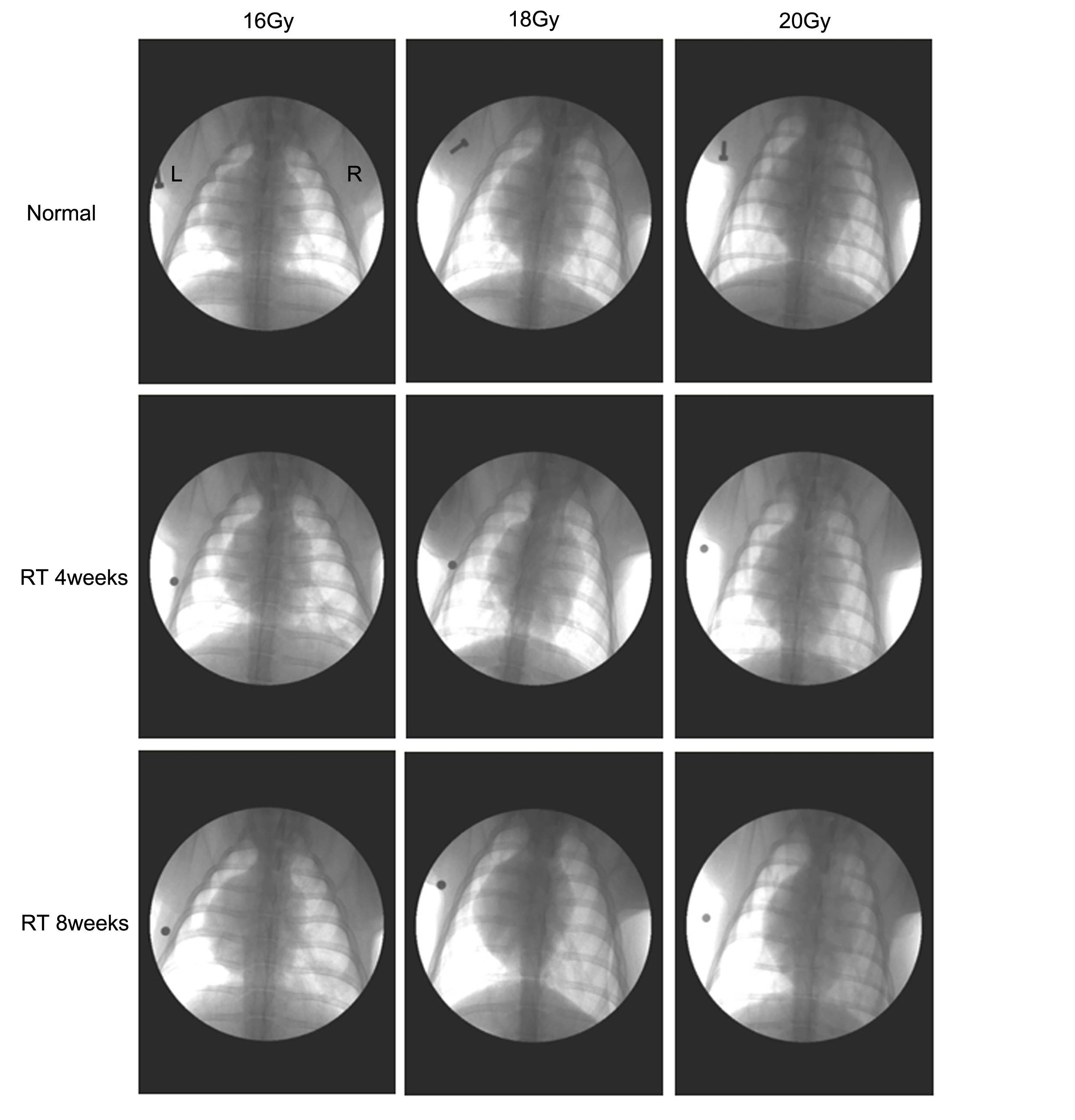 Figure 3. 방사선 피폭 전과 피폭 부 C-arm 촬영 소견