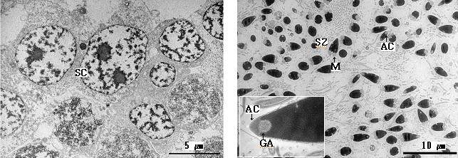 그림 15. 수온조절에 따른 참가리비 정원세포 및 정자 미세구조(2월)