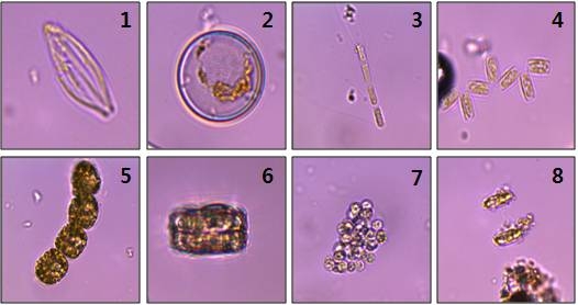 그림 47. 정산포 해수에서 출현한 미세조류.