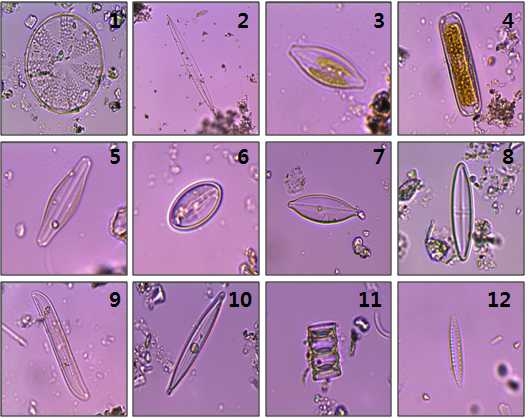 그림 51. 정산포 갯벌 퇴적물에서 출현한 미세조류.