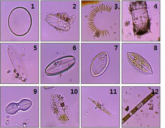 그림 52. 황도리 갯벌 퇴적물에서 출현한 미세조류.