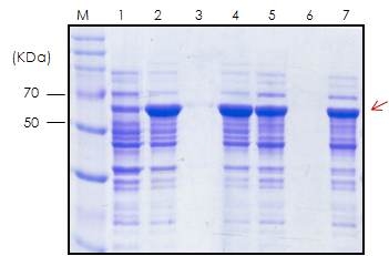 그림 14. E. coli BL21에서 pET22b.6H.MBP.G-CSF 발현 분석.