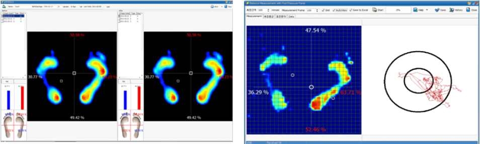 그림 32. 족압 측정검사 및 균형검사 결과화면