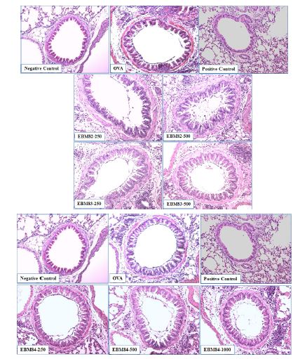 Fig. 30. Inflammatory cells in lung tissue on EBM-82, -83 and ?84 administrated mice