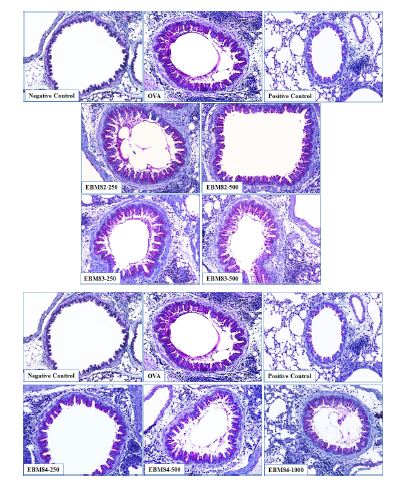 Fig. 31. Mucus production and goblet cell hyperplasia in lung tissue on EBM-82, -83 and ?84 administrated mice