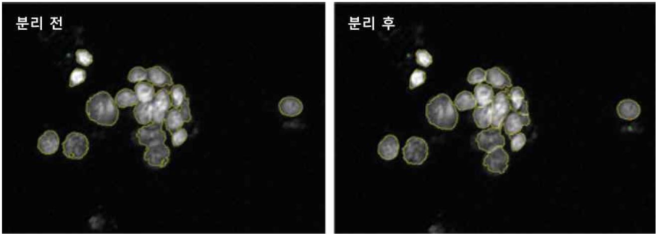 그림 9. Watershed를 이용한 touching/overlapping nuclei 분리 결과