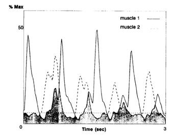 동시수축정도를 이용한 근전도 분석법