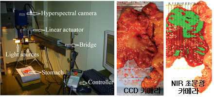 Medical sciences Cancer screening