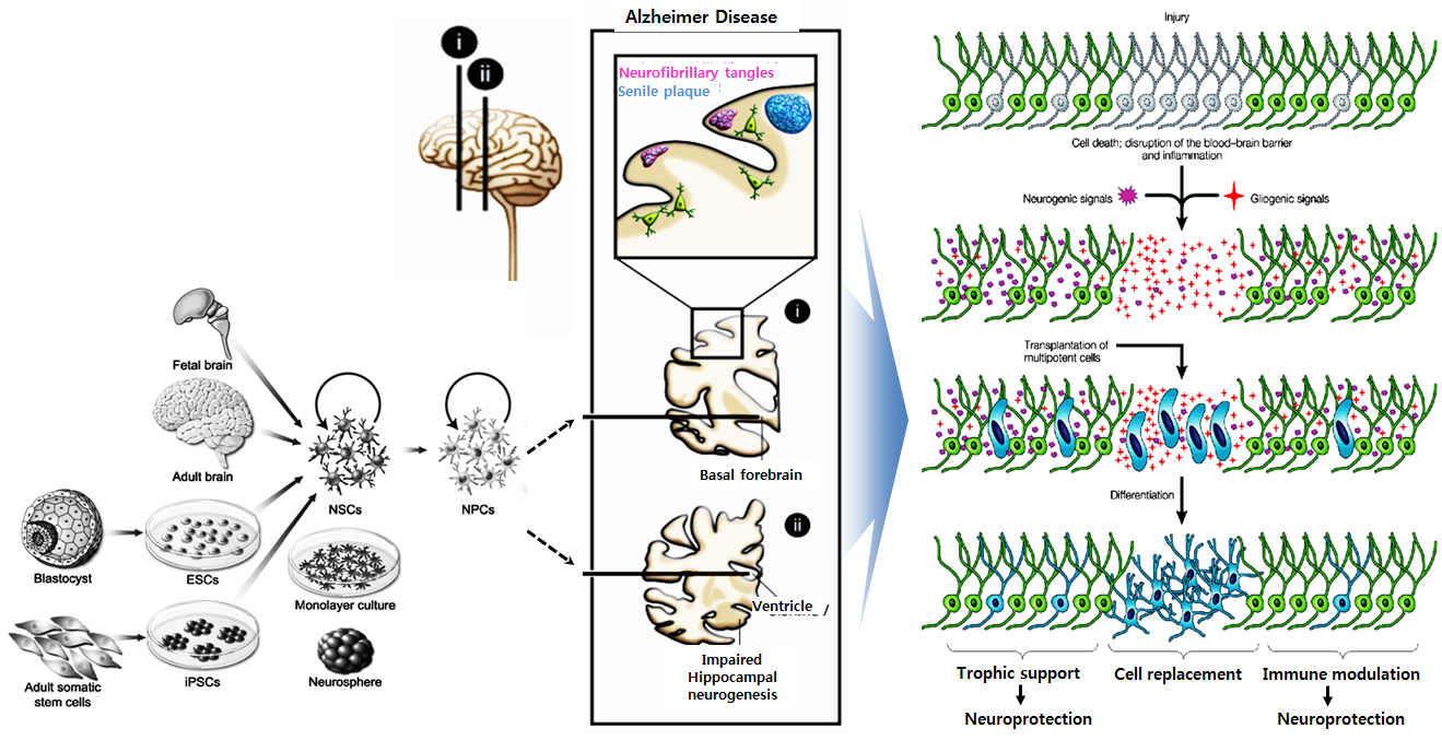 알츠하이머병에 적용 가능한 다양한 신경줄기세포 이식술 모델 및 치료효과