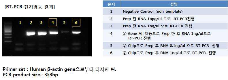 RNA prep의 각각의 전기영동 결과