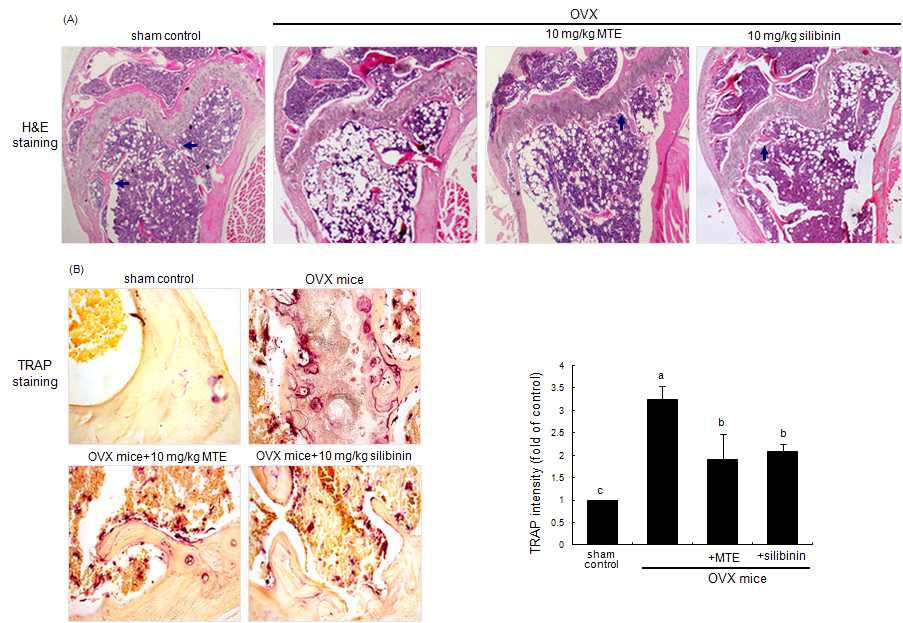 Histological femoral morphology (distal portions of the femora, A) and TRAP localization (B) in femoral bone tissue sections of ovariectomized (OVX) mice administrated with milk thistle extract (MTE) and silibinin.