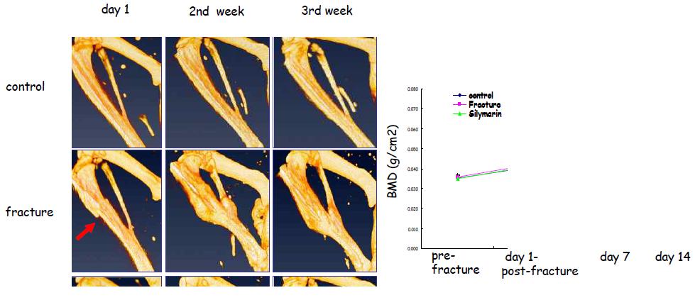 High-resolution three-dimensional radiographic images showing tibial fracture repair of C57BL/6 mice.