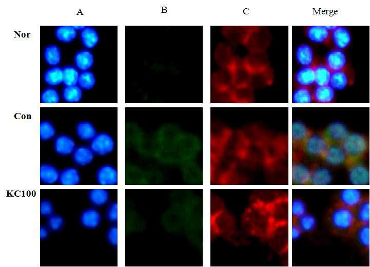 Indirect immunofluorescence and confocal microscopy analysis demonstrating the effect of Kaki Calyx on LPS-induced sub cellular localization of NF-kB/p65 in Raw264.7 cells.