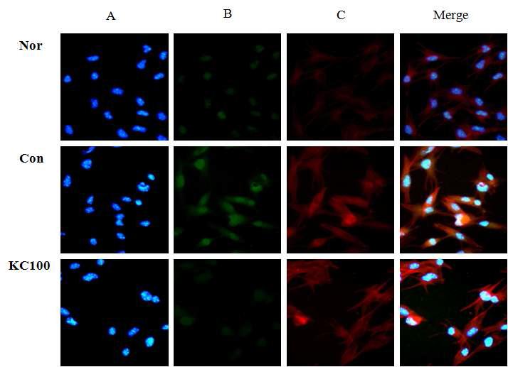 Indirect immunofluorescence and confocal microscopy analysis demonstrating the effect of Kaki Calyx on α-MSH-induced sub cellular localization of MITF in B16F10 cells.