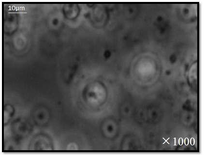 Microscopic aspect of the MLV containing n-BuOH extracta of Kaki Calyx extracted with acetone. (1 month after preparation)