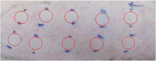 Photograph of the patch test on applied products (Negative 2)