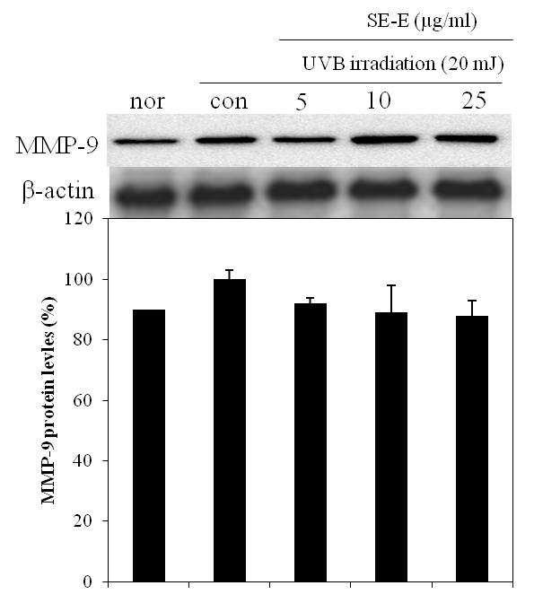 Effects of EtOAC fractions from S. polyrhiza on MMP-9 expression in CCD-986sk cell.