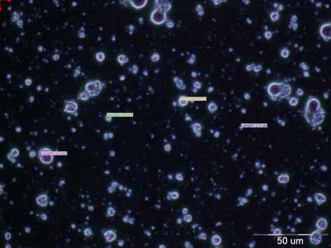 Photograph optical microscopy of experimental formulation RDES1